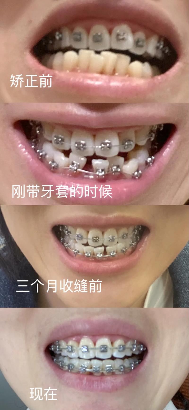 让笑容更美丽——牙美丽口腔的案例分析